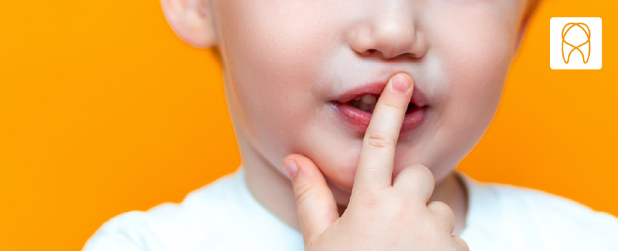 Qué es la agenesia dental infantil y cómo se trata